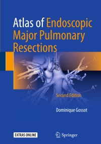 Original PDF Ebook - Atlas of Endoscopic Major Pulmonary Resections2nd Edition - 9783319559001