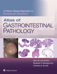 Original PDF Ebook - Atlas of Gastrointestinal Pathology: A Pattern Based Approach to Neoplastic Biopsies - 9781496367549