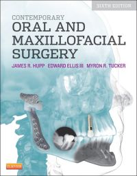 Original PDF Ebook - Contemporary Oral and Maxillofacial Surgery, 6th Edition6th Edition - 9780323091770