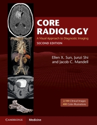 Original PDF Ebook - Core Radiology2nd EditionA Visual Approach to Diagnostic Imaging - 9781108965910