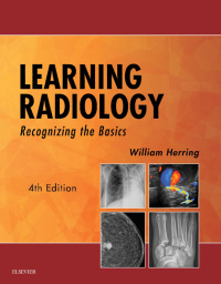 Original PDF Ebook - Learning Radiology4th EditionRecognizing the Basics - 9780323567299