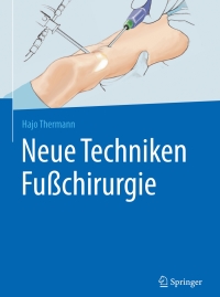 Original PDF Ebook - Neue Techniken Fußchirurgie2nd Edition -9783662527368