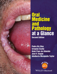 Original PDF Ebook - Oral Medicine and Pathology at a Glance2nd Edition - 9781119121343