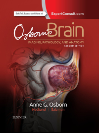 Original PDF Ebook - Osborn's Brain2nd Edition - 9780323477765