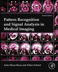 Original PDF Ebook - Pattern Recognition and Signal Analysis in Medical Imaging2nd Edition -9780124095458