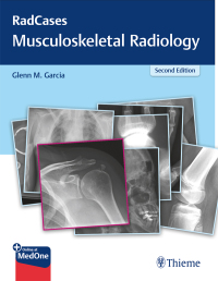 Original PDF Ebook - RadCases Q&A Musculoskeletal Radiology2nd Edition -9781626232457