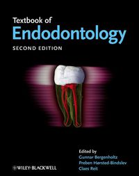 Original PDF Ebook - Textbook of Endodontology 2e2nd Edition - 9781405170956