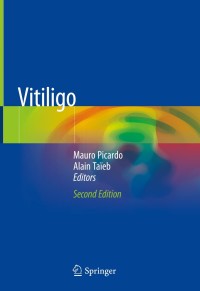 Original PDF Ebook - Vitiligo2nd Edition - 9783319629582