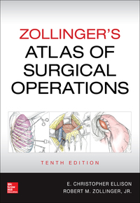 Original PDF Ebook - Zollinger's Atlas of Surgical Operations10th Edition -9780071797559